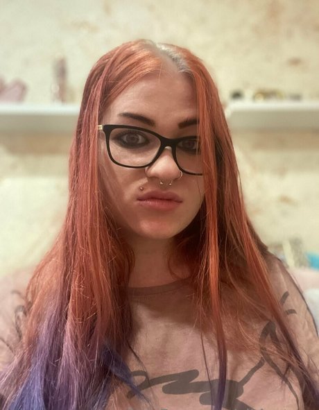 Albinoteen photo 3