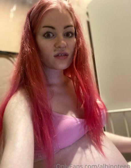 Albinoteen photo 4