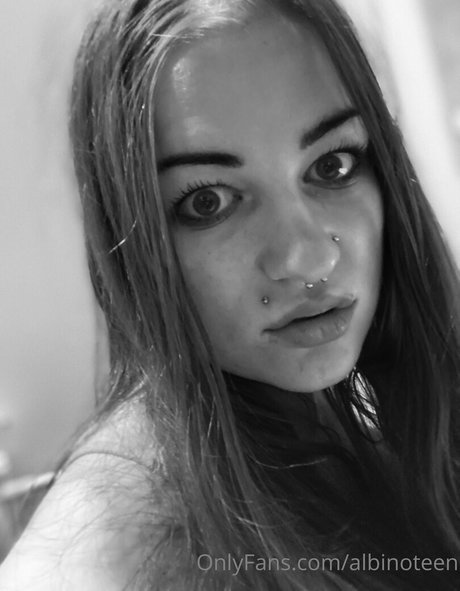 Albinoteen photo 6