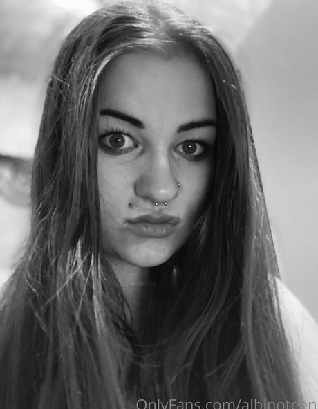 Albinoteen photo 7