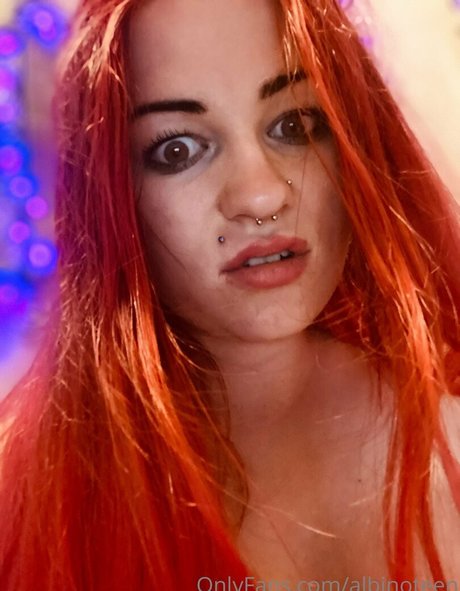 Albinoteen photo 9