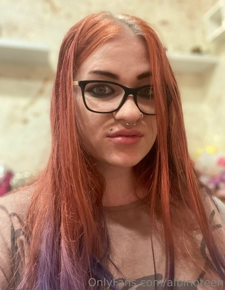 Albinoteen photo 11