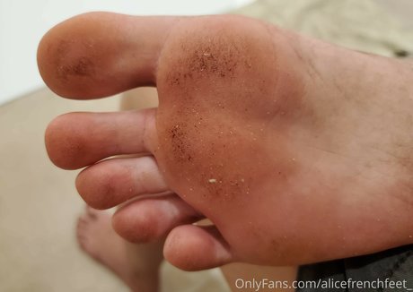 Alicefrenchfeet photo 409