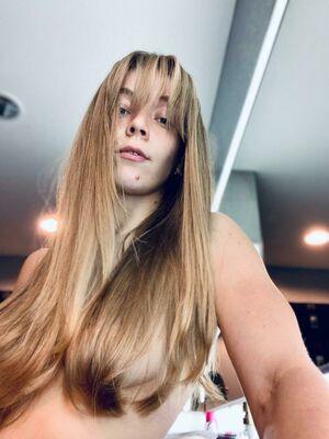 Becky Hill photo 25