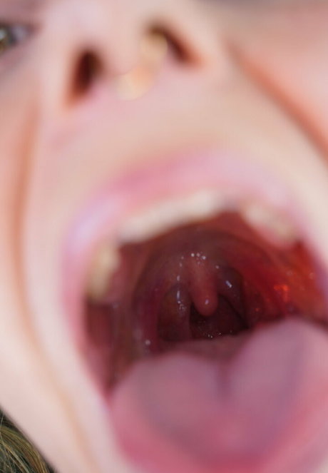 Freakyfjonda photo 86