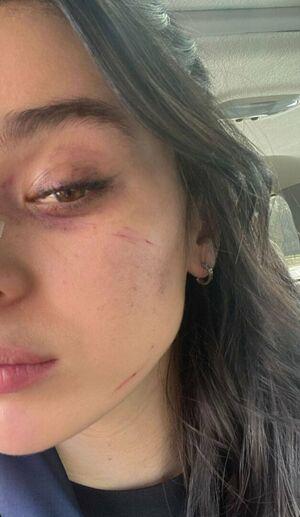 Hailee Steinfeld photo 1500