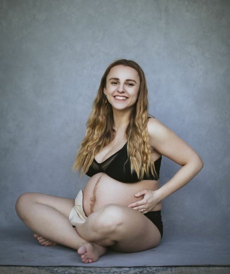 Hannah Witton photo 38