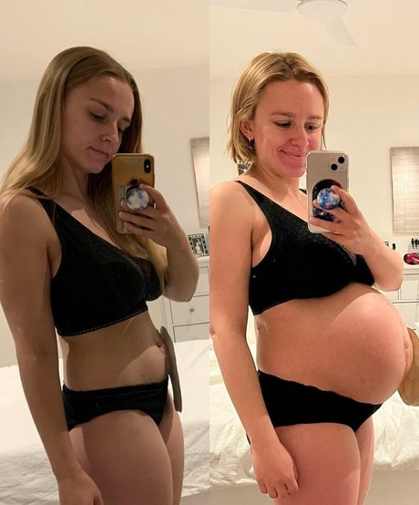 Hannah Witton photo 41