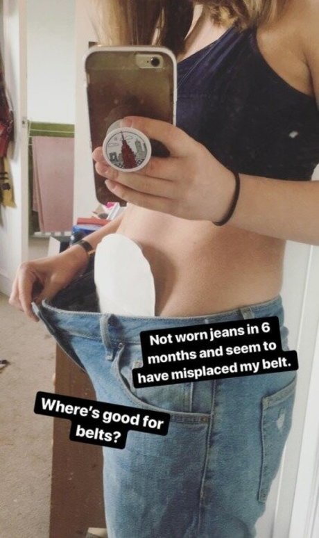 Hannah Witton photo 102