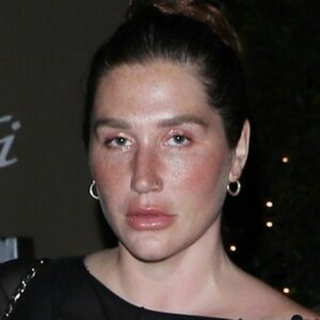 Profile photo of Kesha