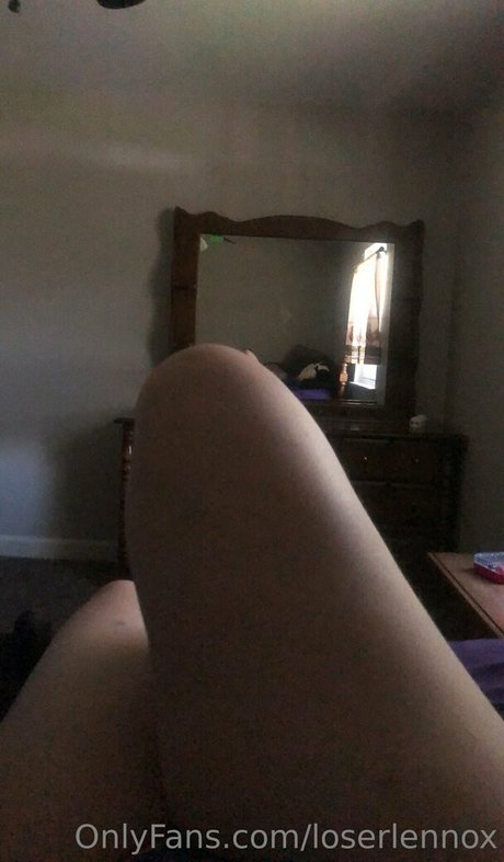 Loserlennox photo 36