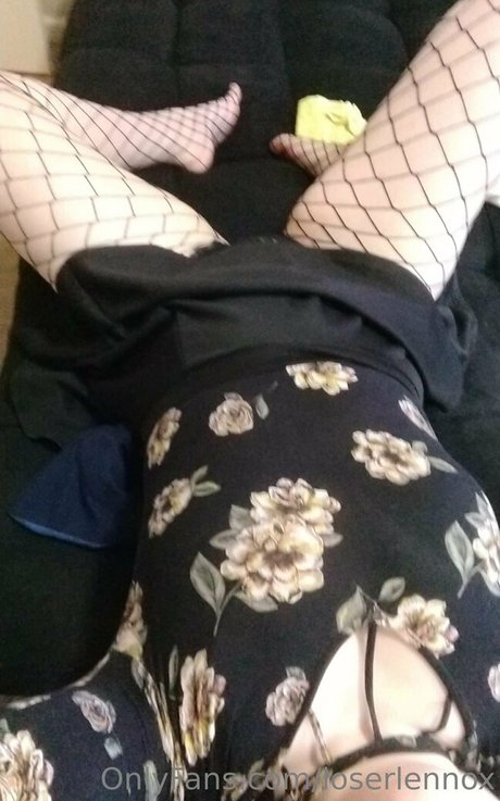 Loserlennox photo 38