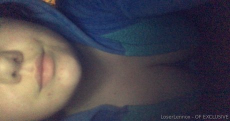 Loserlennox photo 58