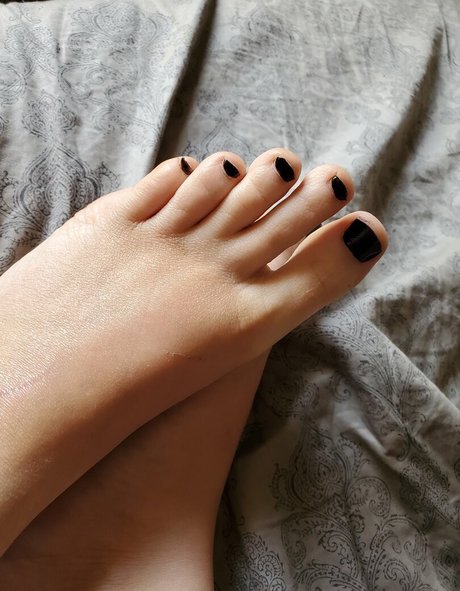 Skeletons_twin photo 40