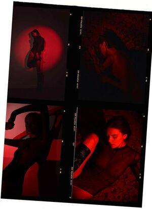 Venosere photo 2