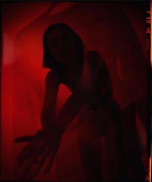 Venosere photo 3