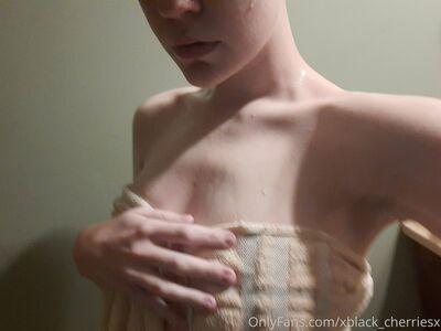 xblack_cherriesx photo 15